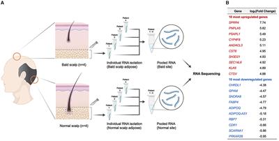 Adipose transcriptome in the scalp of androgenetic alopecia